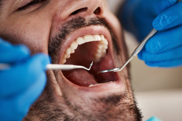Best Urgent Tooth Repair  in Mountlake Terrace, WA